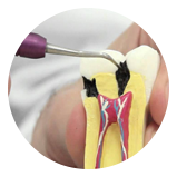 Ananda Odontologia - Endodontia