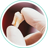 Ananda Odontologia - Extração Dentária