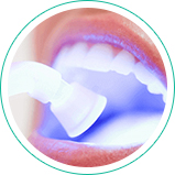 Ananda Odontologia - Restauração Dentária